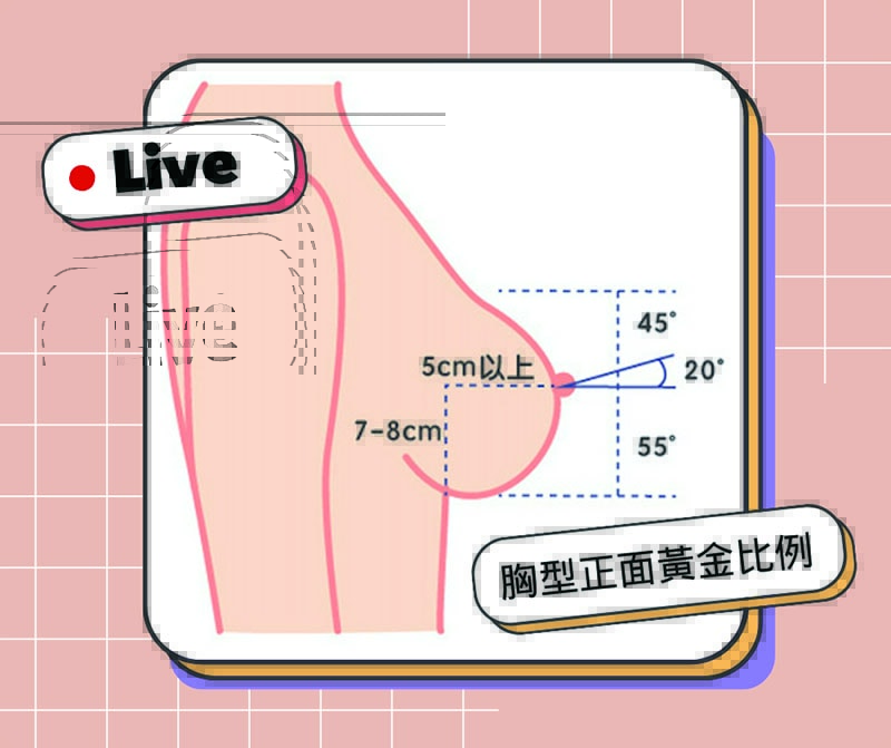 不同胸型的隆乳術式解析 下垂外擴大小奶產後萎縮都有解 - 第5張圖