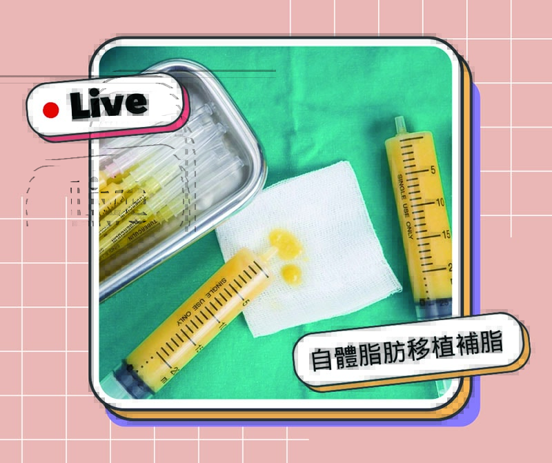 隆乳必5大成功要素!手術方式、切口、擺放位置、術後照護通通告訴你! - 第5張圖