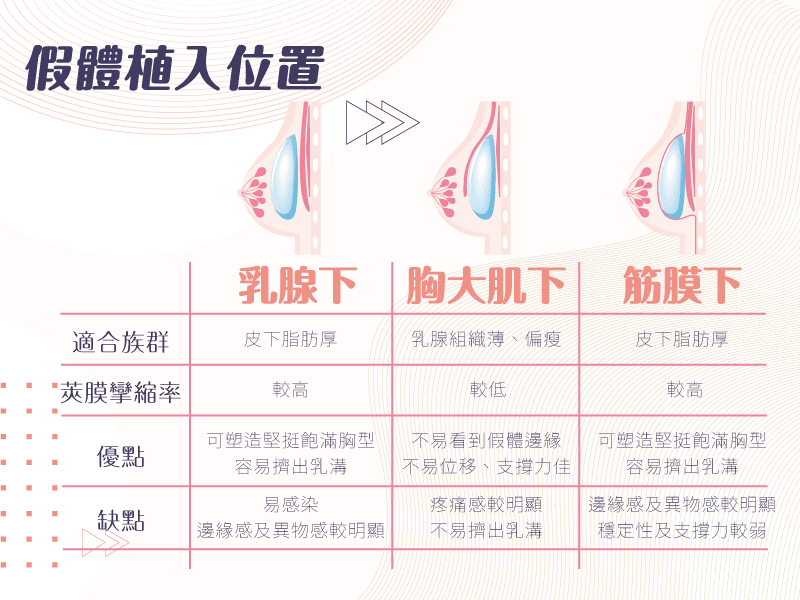 隆乳術後可能面臨5大問題係金A?如何避免位移、水波紋、莢膜孿縮、蟹足腫、二次隆乳一次告訴你! - 第4張圖