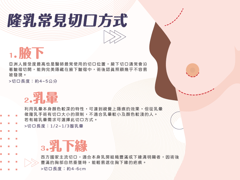 隆乳必5大成功要素!手術方式、切口、擺放位置、術後照護通通告訴你! - 第7張圖